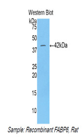 Western Blot; Sample: Recombinant protein.