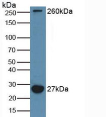 Western Blot; Sample: Mouse Brain Tissue.