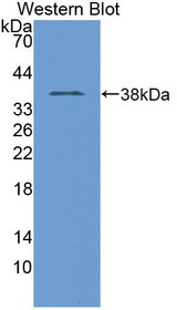 Western Blot; Sample: Recombinant protein.