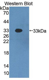 Western Blot; Sample: Recombinant protein.