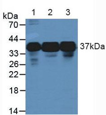 Western Blot; Sample: Lane1: Human A549 Cells; Lane2: Human Jurkat Cells; Lane3: Human K562 Cells.