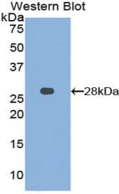 Western Blot; Sample: Recombinant protein.