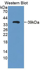Western Blot; Sample: Recombinant protein.