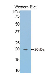 Western Blot; Sample: Recombinant protein.