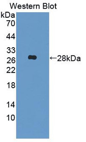 Western Blot; Sample: Recombinant protein.
