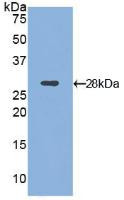 Western Blot; Sample: Recombinant ITGaD, Mouse.