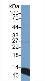 Western Blot; Sample: Rat Liver lysate; Primary Ab: 1µg/ml Rabbit Anti-Rat b2M Antibody Second Ab: 0.2µg/mL HRP-Linked Caprine Anti-Rabbit IgG Polyclonal Antibody