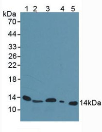 Western Blot; Sample: Lane1: Mouse Serum; Lane2: Mouse Spleen Tissue; Lane3: Mouse Liver Tissue; Lane4: Rat Liver Tissue; Lane5: Human Urine.