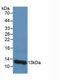 Western Blot; Sample: Human Urine Tissue.