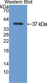 Western Blot; Sample: Recombinant protein.