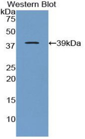Western Blot; Sample: Recombinant protein.