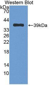 Western Blot; Sample: Recombinant protein.