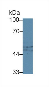 Western Blot; Sample: Rat Liver lysate; ;Primary Ab: 3µg/ml Rabbit Anti-Rat C1INH Antibody;Second Ab: 0.2µg/mL HRP-Linked Caprine Anti-Rabbit IgG Polyclonal Antibody;