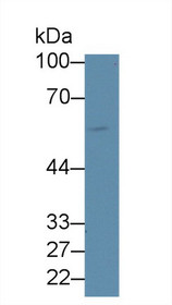 Western Blot; Sample: Human 293T cell lysate; ;Primary Ab: 3µg/ml Rabbit Anti-Mouse IL2Rb Antibody;Second Ab: 0.2µg/mL HRP-Linked Caprine Anti-Rabbit IgG Polyclonal Antibody;