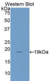 Western Blot; Sample: Recombinant protein.
