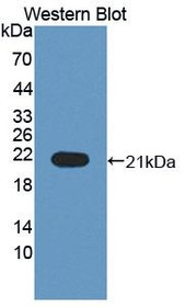 Western Blot; Sample: Recombinant protein.