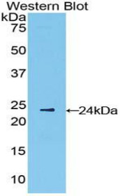 Western Blot; Sample: Recombinant protein.