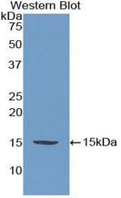 Western Blot; Sample: Recombinant protein.