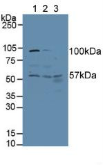 Western Blot; Sample: Lane1: Human Hela Cells; Lane2: Human A431 Cells; Lane3: Human Liver Tissue.