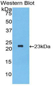 Western Blot; Sample: Recombinant protein.
