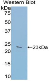 Western Blot; Sample: Recombinant protein.