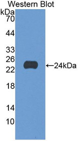 Western Blot; Sample: Recombinant protein.