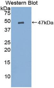Western Blot; Sample: Recombinant protein.