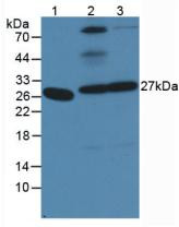 Western Blot; Sample: Lane1: Human Serum; Lane2: Mouse Stomach Tissue; Lane3: Mouse Intestine Tissue.
