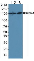 Western Blot; Sample: Lane1: Mouse Placenta Tissue; Lane2: Mouse Liver Tissue; Lane3: Human Hela Cells.