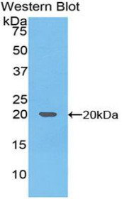 Western Blot; Sample: Recombinant protein.