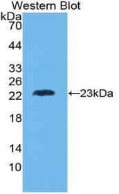 Western Blot; Sample: Recombinant protein.