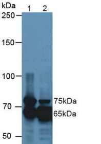 Western Blot; Sample: Lane1: Mouse Kidney Tissue; Lane2: Mouse Eye Tissue.