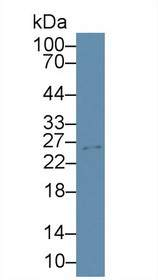 Western Blot; Sample: Mouse Cerebrum lysate; ;Primary Ab: 3µg/ml Rabbit Anti-Mouse TIMP4 Antibody;Second Ab: 0.2µg/mL HRP-Linked Caprine Anti-Rabbit IgG Polyclonal Antibody;