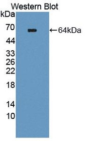 Western Blot; Sample: Recombinant protein.