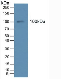 Western Blot; Sample: Human Serum.