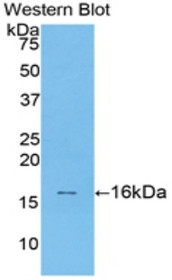Western Blot; Sample: Recombinant protein.