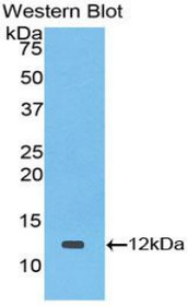 Western Blot; Sample: Recombinant protein.