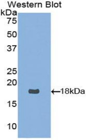 Western Blot; Sample: Recombinant protein.