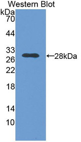 Western Blot; Sample: Recombinant protein.