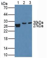 Western Blot; Sample. Lane1: Human Urine; Lane2: Porcine Lung Tissue; Lane3: Mouse Placenta Tissue.