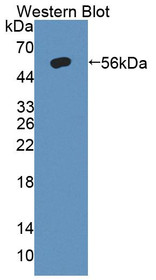 Western Blot; Sample: Recombinant protein.