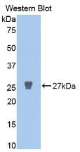Western Blot ;Sample: Recombinant MMP2, Human.