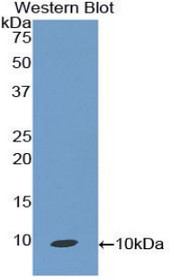 Western Blot; Sample: Recombinant protein.
