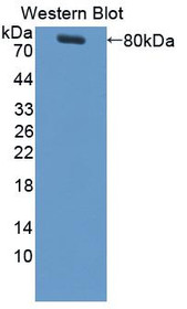 Western Blot; Sample: Recombinant protein.