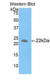 Western Blot; Sample: Recombinant protein.