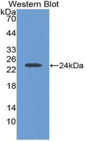 Western Blot; Sample: Recombinant protein.