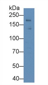 Western Blot; Sample: Rat Heart lysate; ;Primary Ab: 1µg/ml Rabbit Anti-Rat LEPR Antibody;Second Ab: 0.2µg/mL HRP-Linked Caprine Anti-Rabbit IgG Polyclonal Antibody;