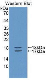 Western Blot; Sample: Recombinant protein.