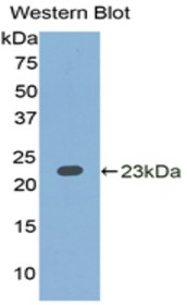 Western Blot; Sample: Recombinant protein.