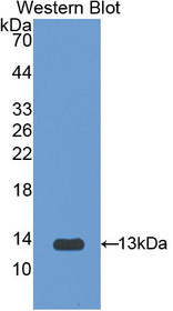 Western Blot; Sample: Recombinant protein.